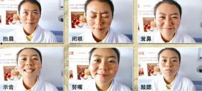 面瘫艾灸视频,轻松缓解面部不适,恢复微笑